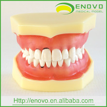 EN-L3 Removable Dental Soft Peridontal Teeth Model for Training